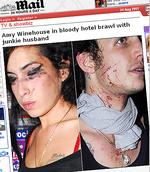 Amy Winehouse: Blutige Prügelei mit Ehemann