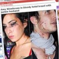 Amy Winehouse - Blutige Prügelei mit Ehemann
